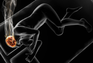 accidental overdose of diazepam antidote accidental overdose of diazepam antidote