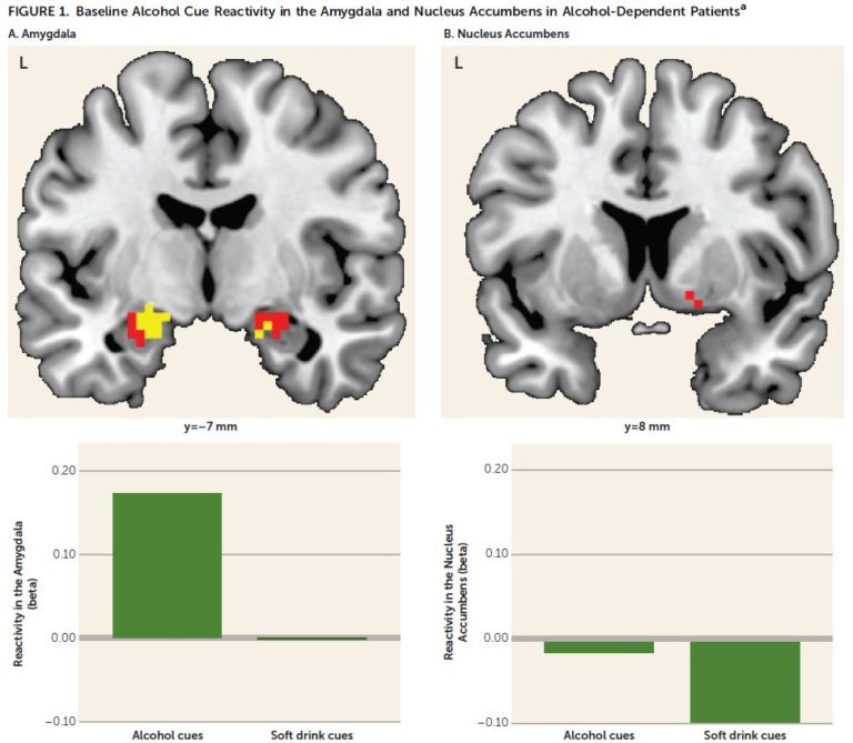 Baseline alcohol cue reactivity in the amygdala and necleus accumbens ...