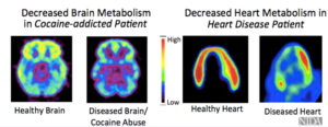 HOW ADDICTION AFFECT METABOLISM, HEART, AND BRAIN FUNCTION